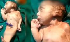 فیلم تولد عجیب خلقه ترین نوزاد جهان ! / نه پری دریایی نه انسان !